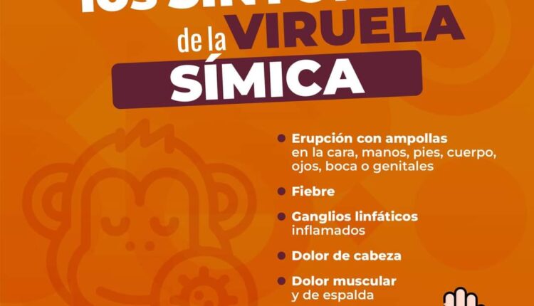 viruela símica