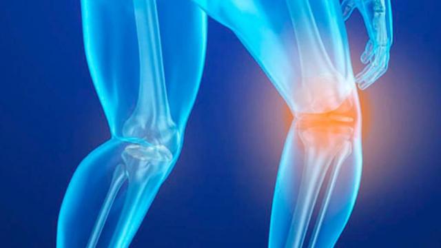 New Project - 2019-11-08T122048.636 Osteoporosis costaría al país más de 6 mil mdp en 2020, alerta experta