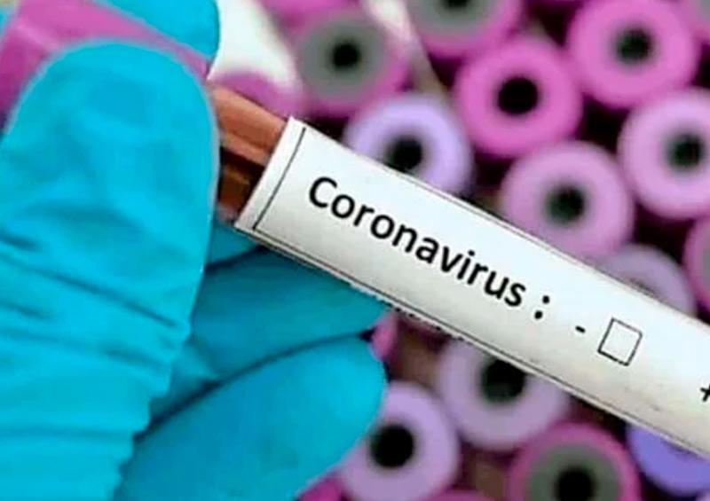 2020-02-29-monterrey Preparan protocolos para coronavirus en Nuevo León
