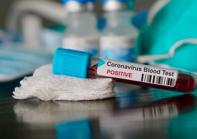 coronavirus Detienen a hombre que dijo a su jefe tener coronavirus para no ir a trabajar