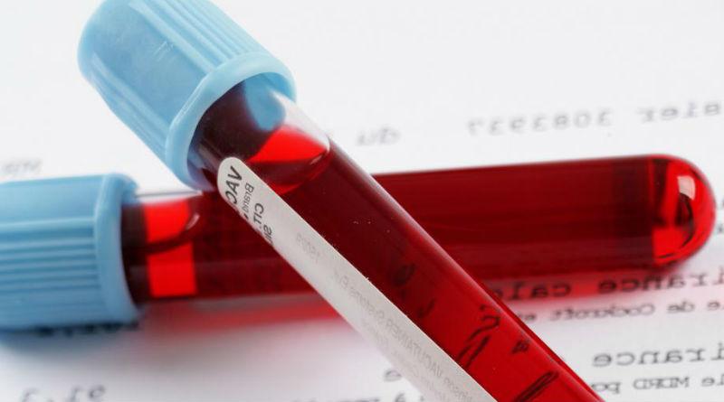 motivos-de-plaquetas-altas-en-la-sangre Revelan qué tipo de sangre es más propenso al Covid-19